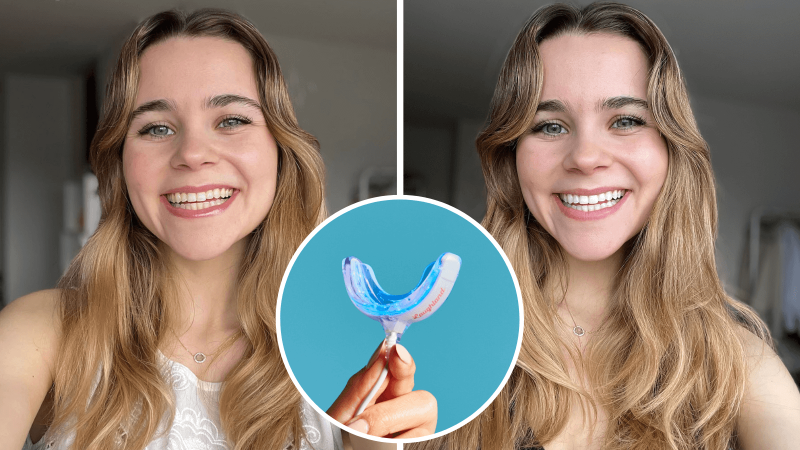 New Studies Show That Whiter Teeth Can Lead to Greater Success in Love and Work