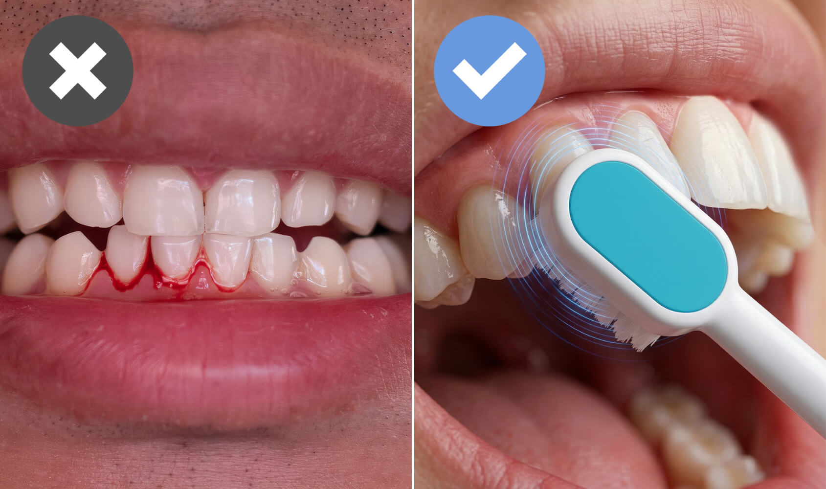 Regular and Electric Toothbrushes Could Be Ruining Your Gums, Here's What Dentists Are Quietly Recommending Instead